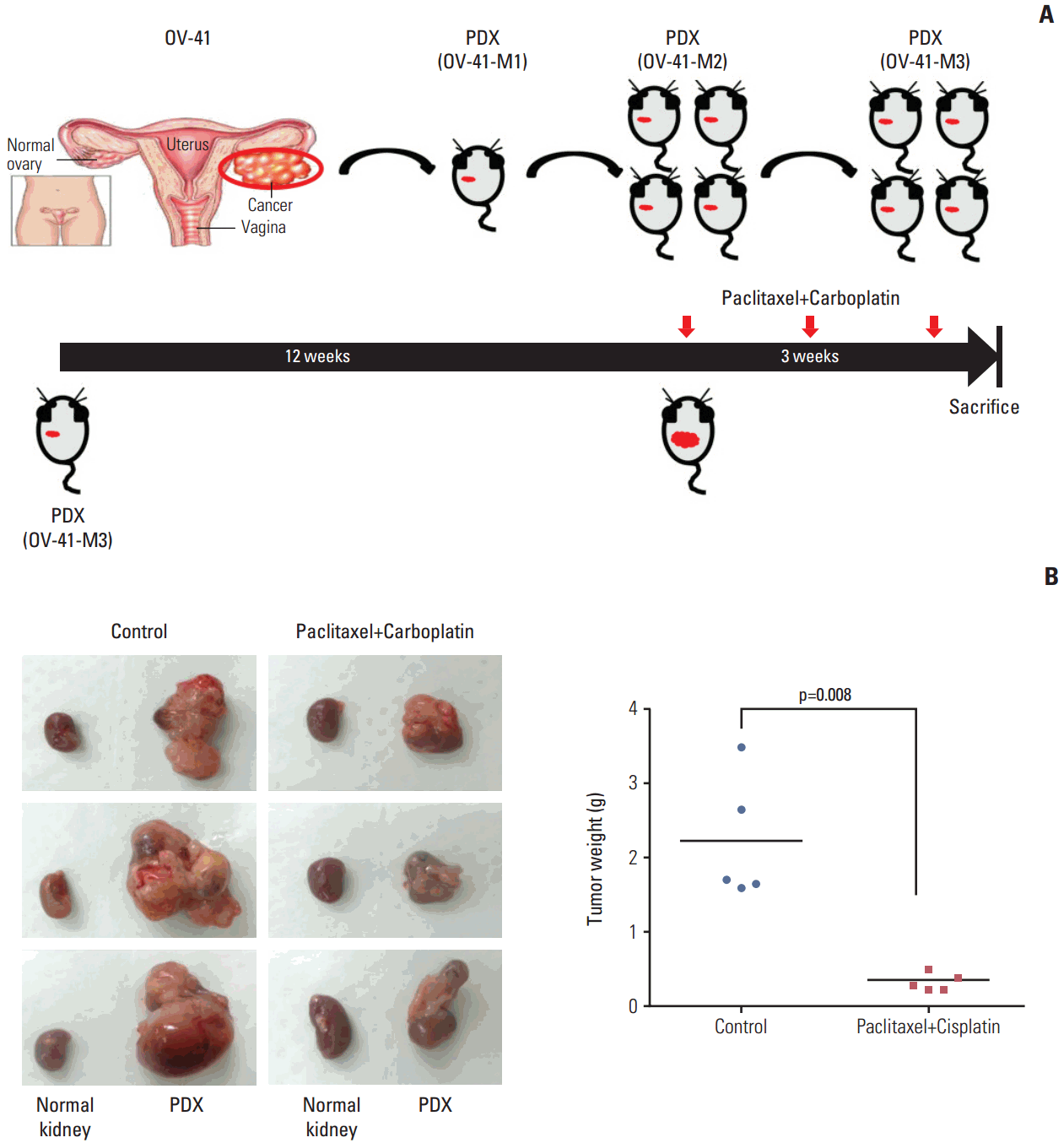 ovarian cancer xenografts mice